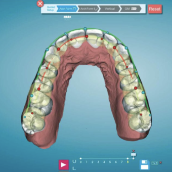 Clinical Products Spotlight: New Tools Makes Complex Cases Even Easier