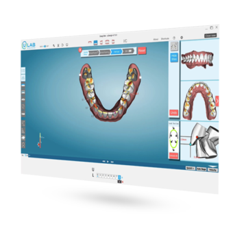 uLab™ shortens treatment planning time for all case complexities with uDesign 7.0; now with AI-assisted staging and a concierge planning assistance service